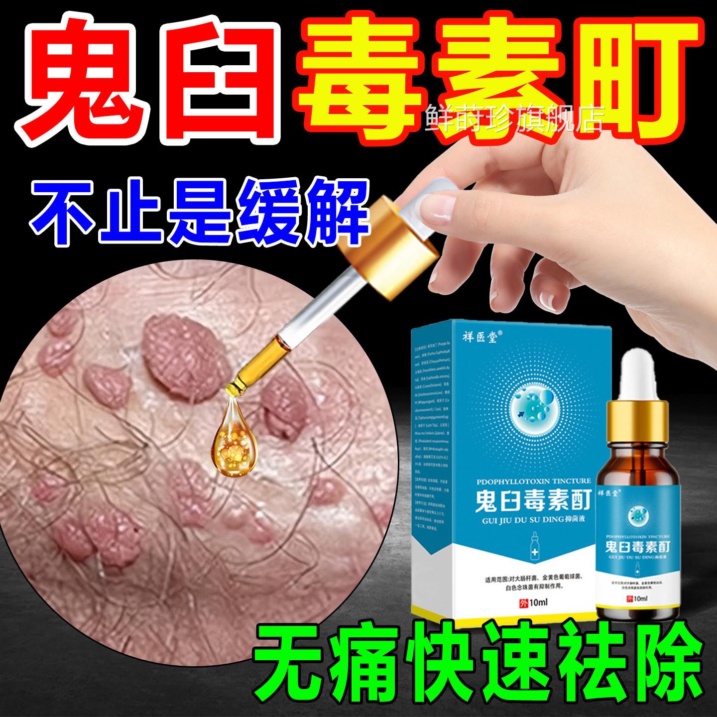 臼毒素酊软膏皮鬼肤清洁抑菌液外用尖锐湿扁平尤犹官方正品旗舰店