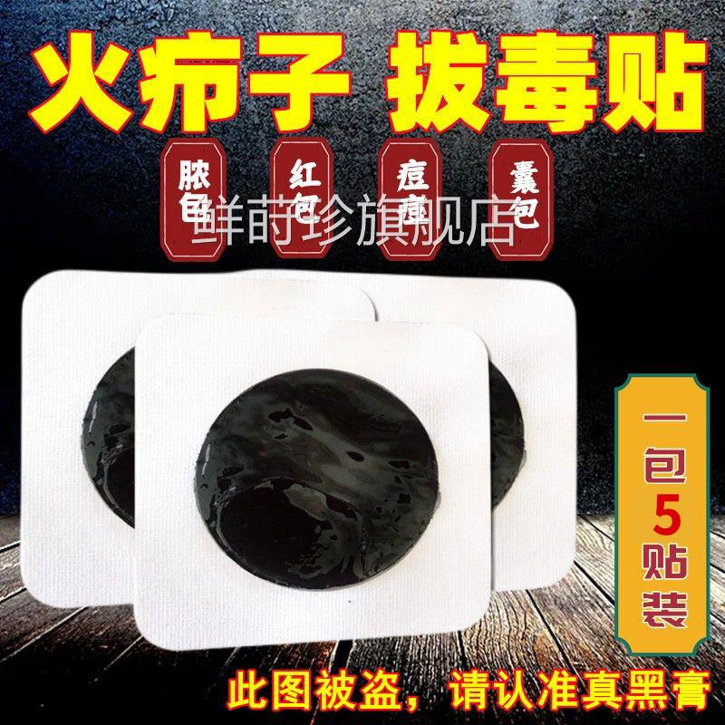 火疖子拔毒贴去吸脓包屁股脓包红肿硬疙瘩拔脓用贴专传统黑膏药贴
