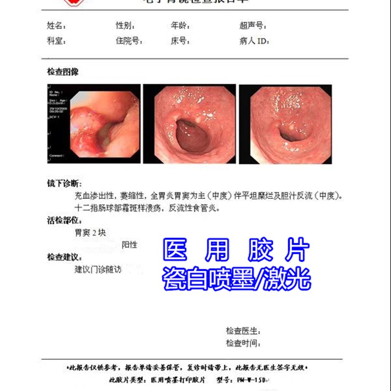 医院用胶片喷墨 激光瓷白半透明彩色胃镜B超四维彩超打印胶片纸