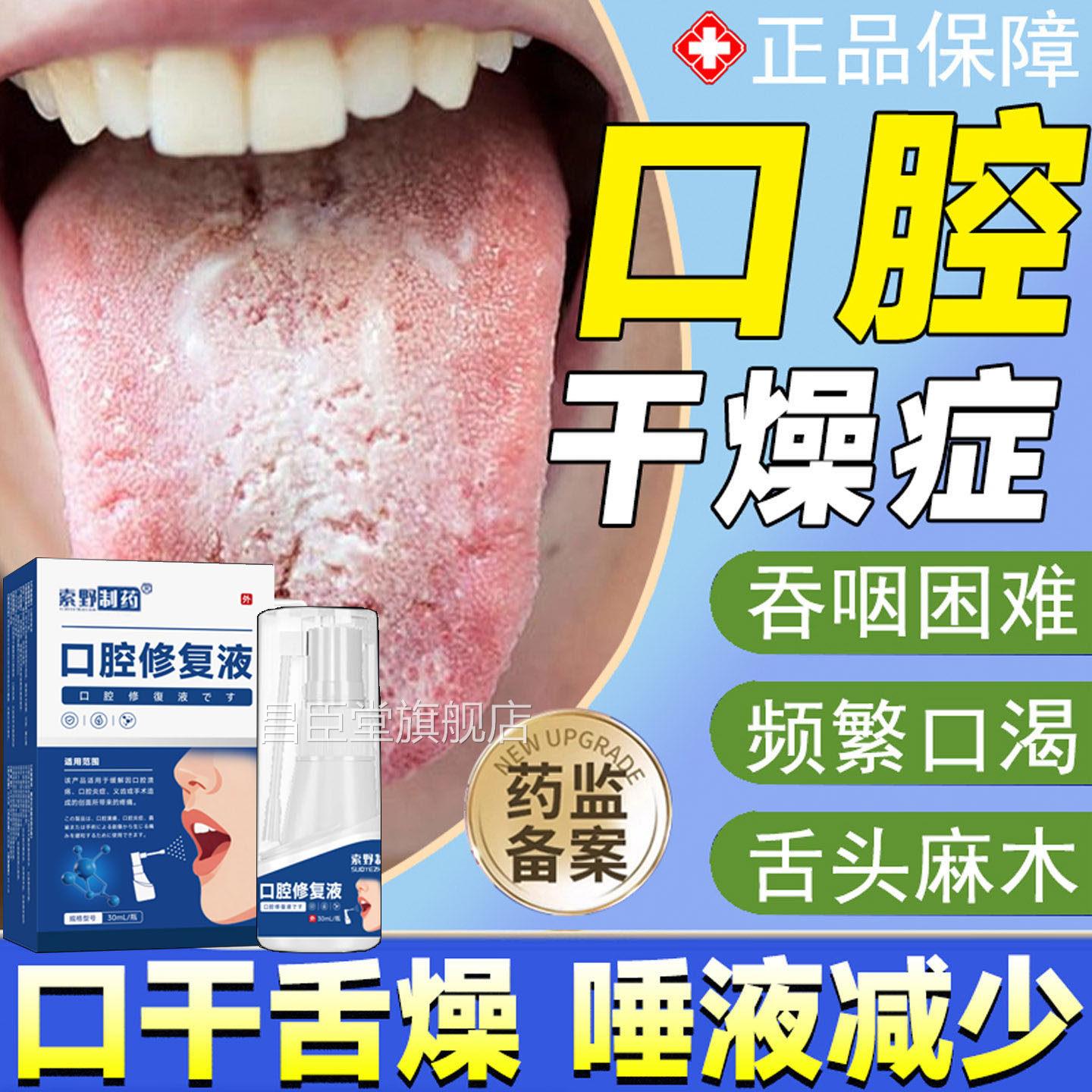 口腔干燥人工唾干燥综合征喉咙干燥液津液不足口苦口干舌燥喷剂TK