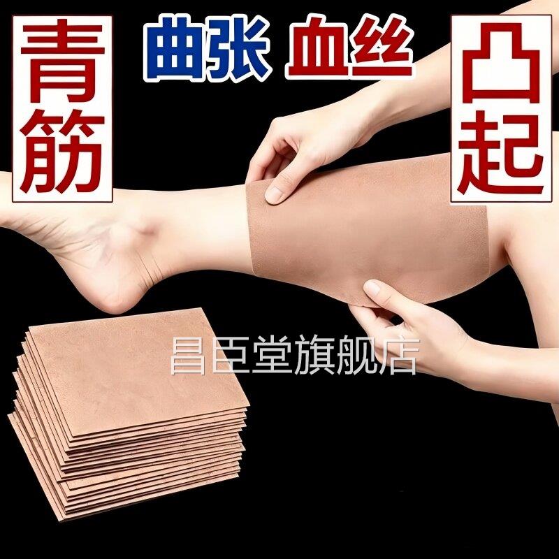 静脉曲张腿部青丝筋凸起蚯蚓腿血管肿胀红血医用贴膏官方正品昌臣