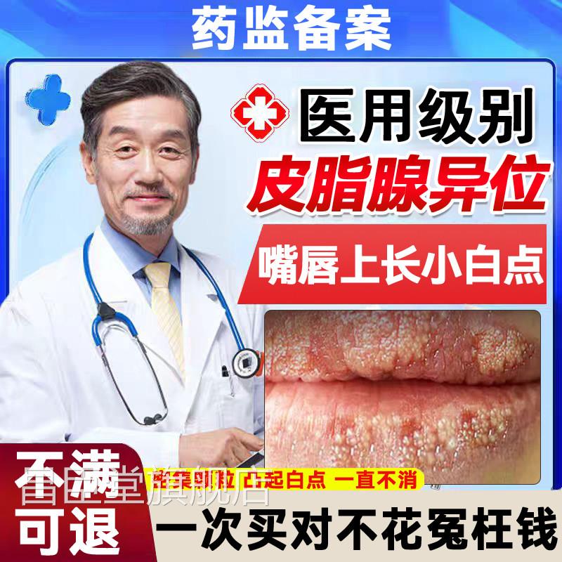皮脂腺异位症嘴唇白点脂肪小颗粒白增生去除色干裂脱皮药膏TK昌臣