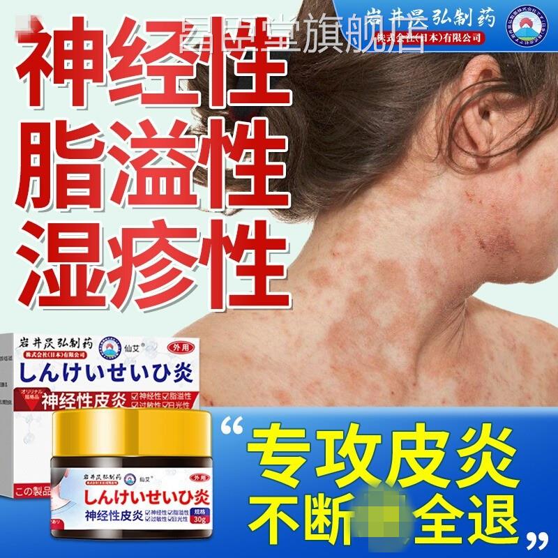 炎神经性溢脂性面部搭去止痒外用膏除顽固皮皮肤瘙痒湿昌臣堂旗舰