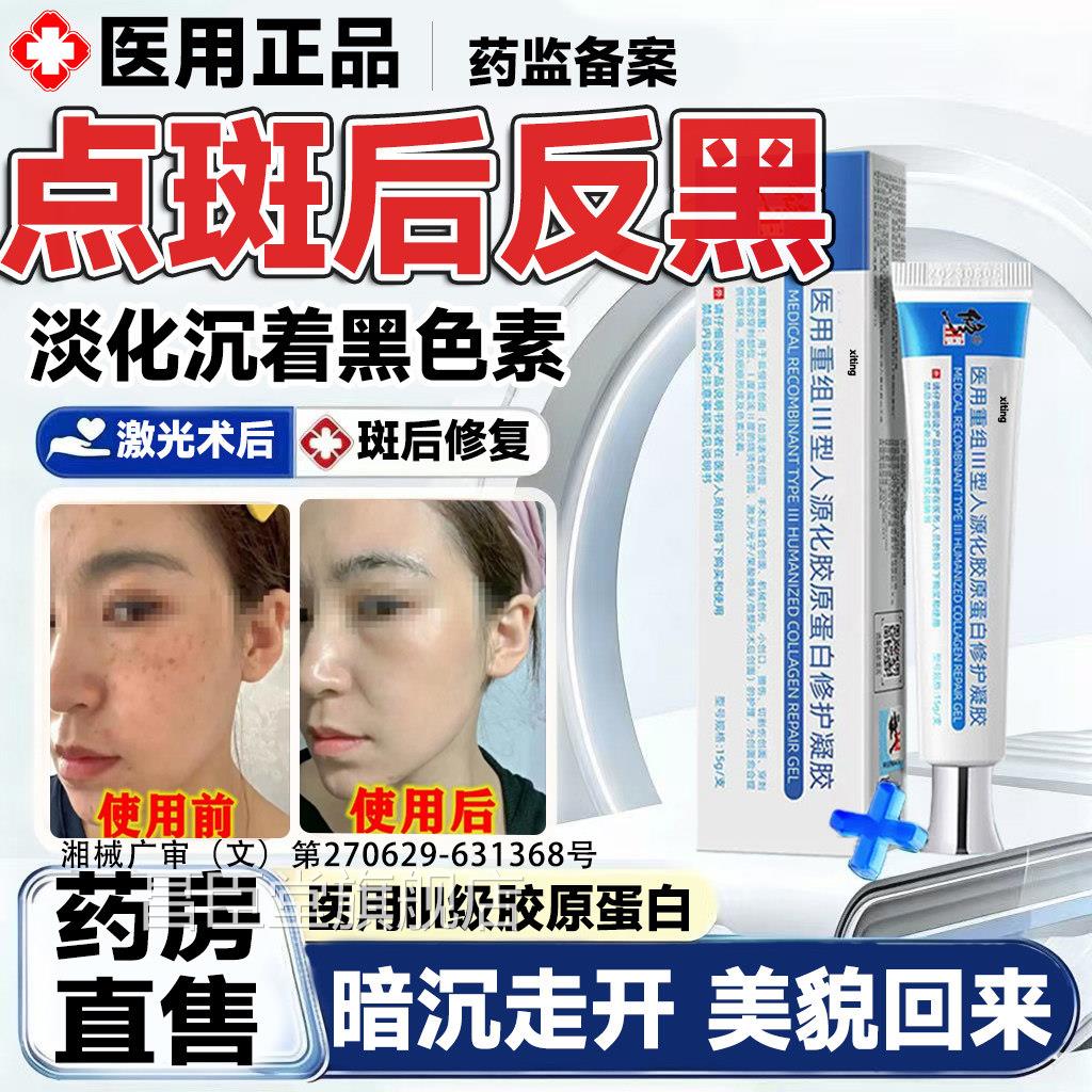 祛斑后反黑修控色霜面复部点斑激光术后美容院专用淡化去黑色素LT
