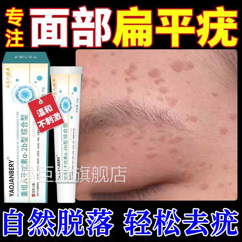 干扰素b2凝胶去疣药膏扁平疣丝状神器去除膏一抹灵部面颈专用UU昌