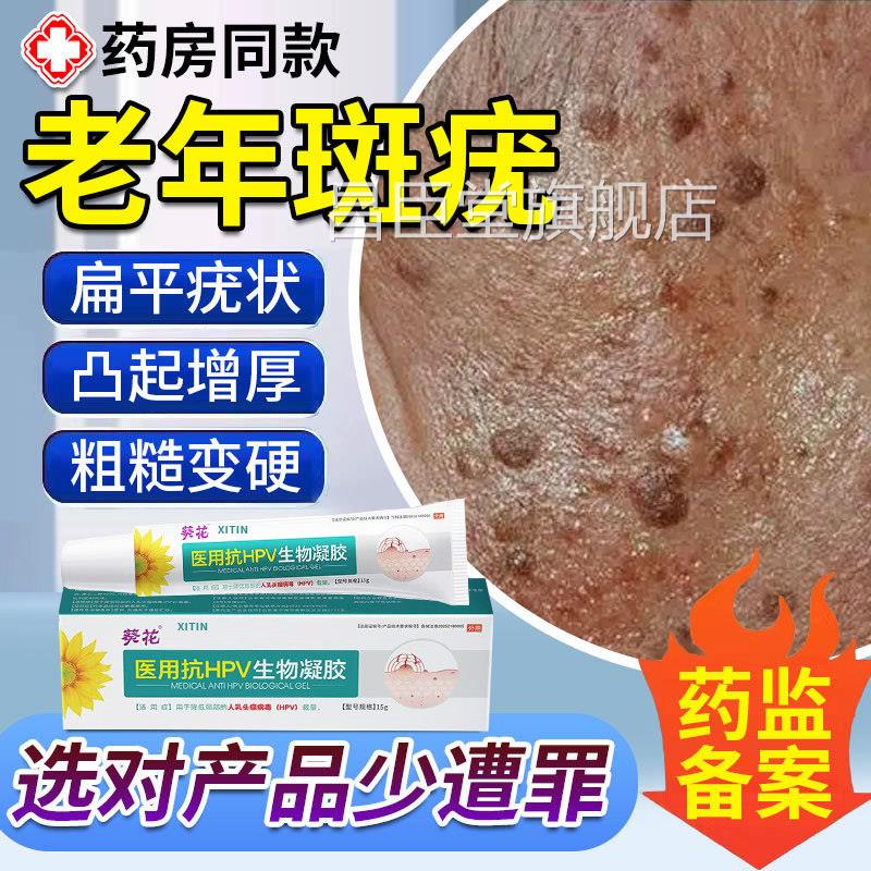 脸上扁平疣专用老年斑增厚凸起老人疣一抹灵专用去脸部黑斑除膏UU
