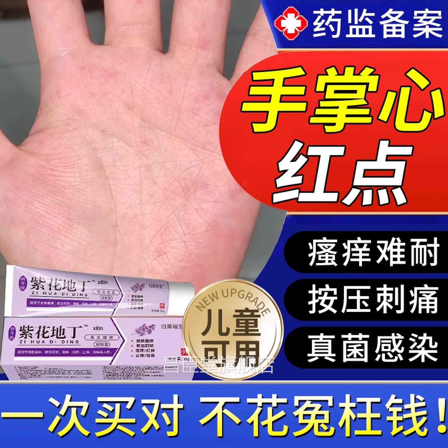 手心手掌疱红点瘙痒脱皮湿疹专用除湿止痒真菌感染手气水泡汗疹TT