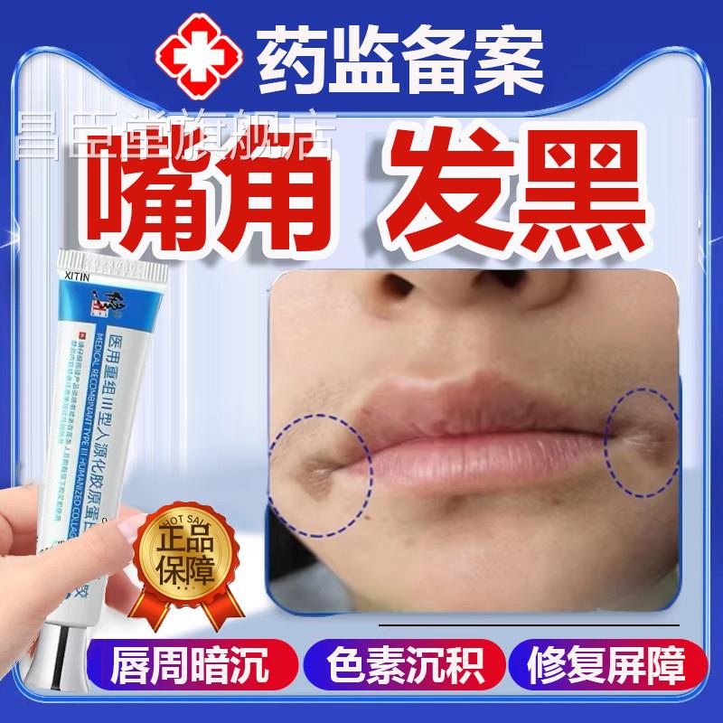 角发黑黑色素沉淀去除嘴巴周边黑唇周黑嘴角暗沉唇炎色素沉着P嘴P