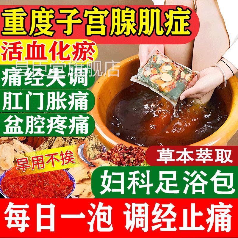 子宫腺肌症的药内膜异位宫寒痛经纤维肌贴瘤中药泡脚包调理盆腔GX