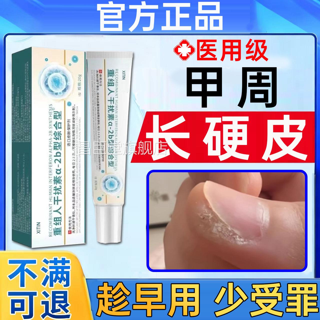 软化甲周硬皮手指甲边去缘死皮老硬茧去除角质变硬专用修复凝胶UU