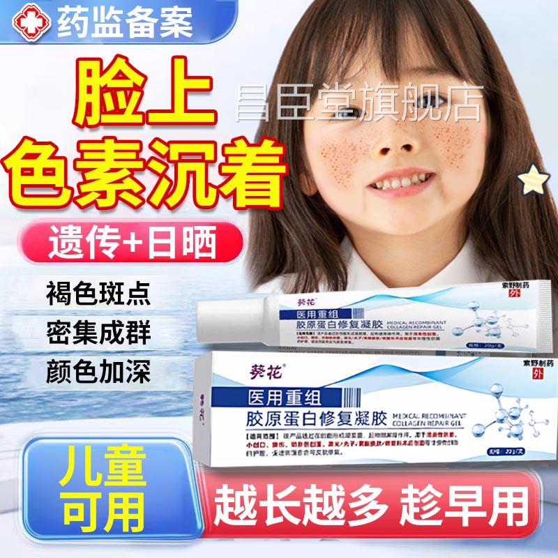 祛儿童脸上有雀斑除专用膏去脸部祛斑膏小孩祛斑霜淡斑备案ZY昌臣