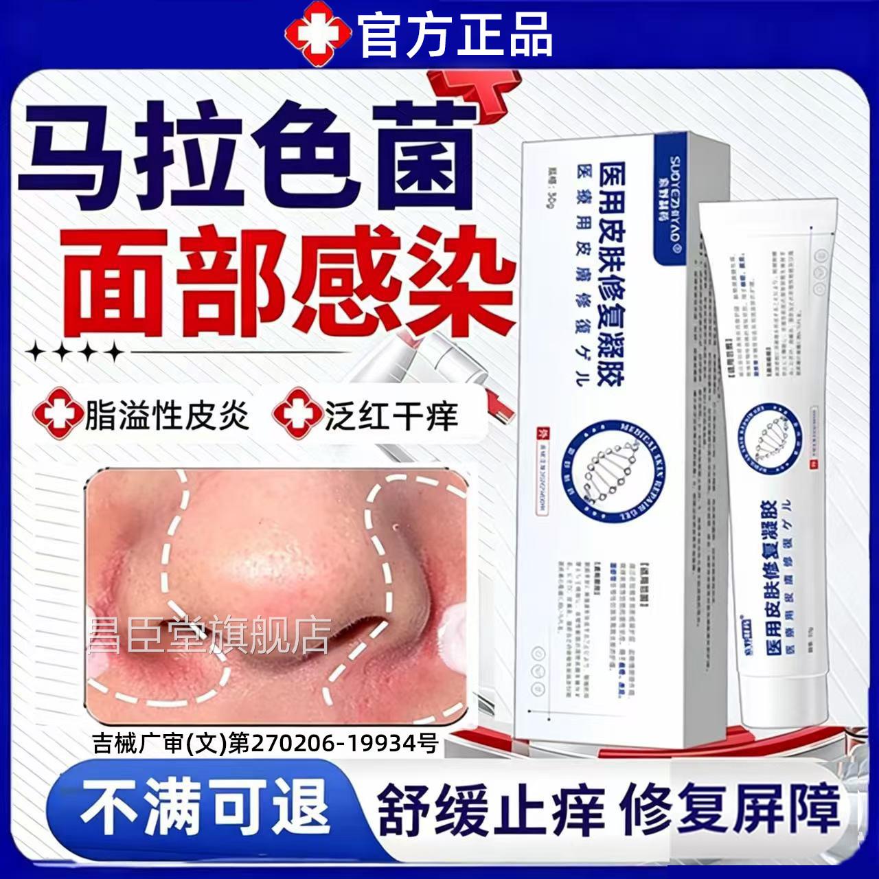 马拉色菌脂溢性皮炎面部护肤品鼻翼子侧两泛红脱皮干燥修复软膏XH