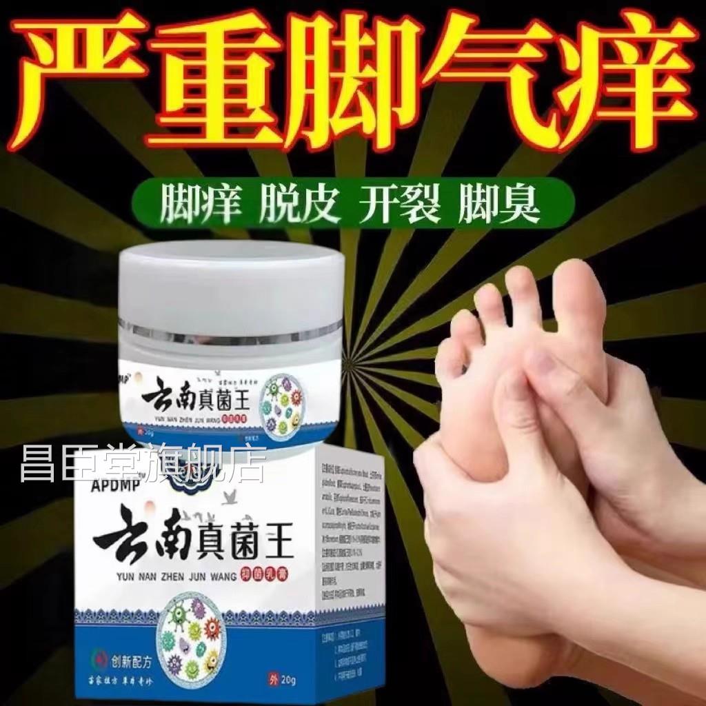云南真菌有王脚/气泡痒脚烂了脚缝烂脚裂防止水泡脚脱皮脚趾臭昌