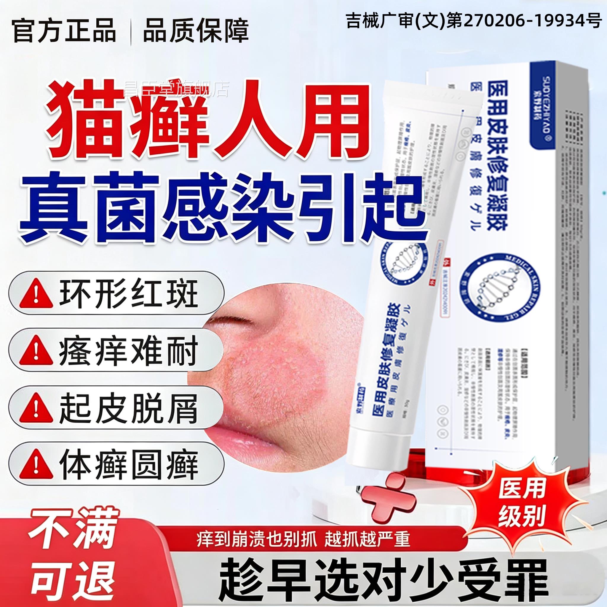 猫售癣人用脸上长藓圆圈红斑真菌感染铜钱癣体癣止痒专用药房同QQ