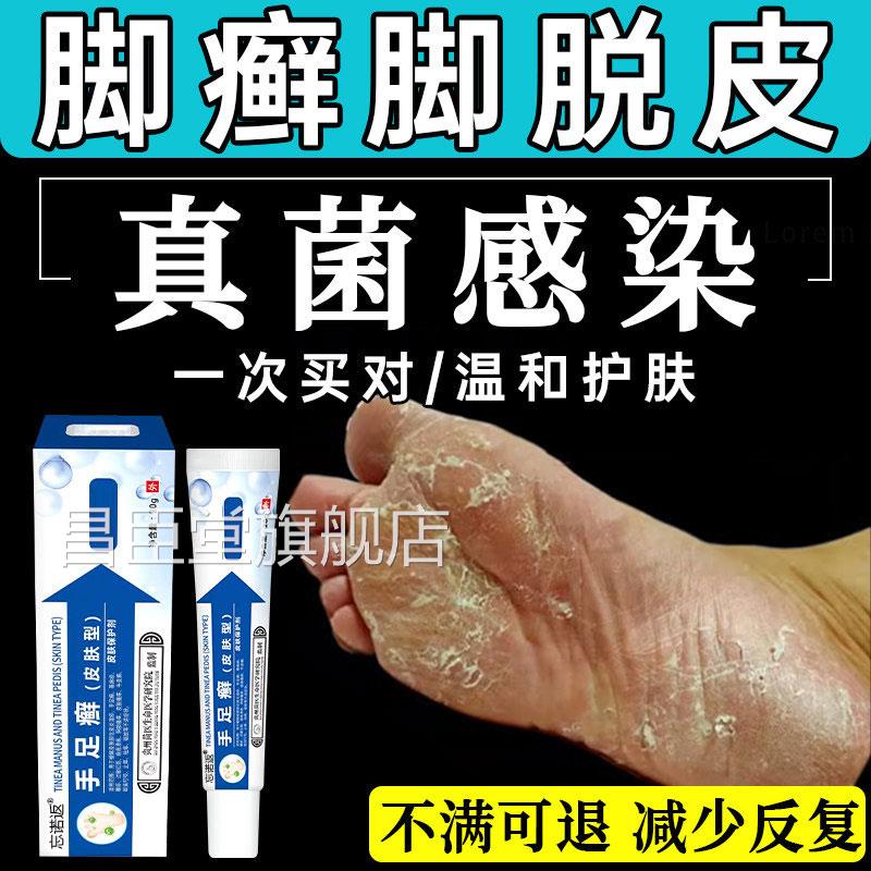 角化型足癣脚癣一次净官方旗舰店脚贵脱皮干裂真菌感染州神奇止UU