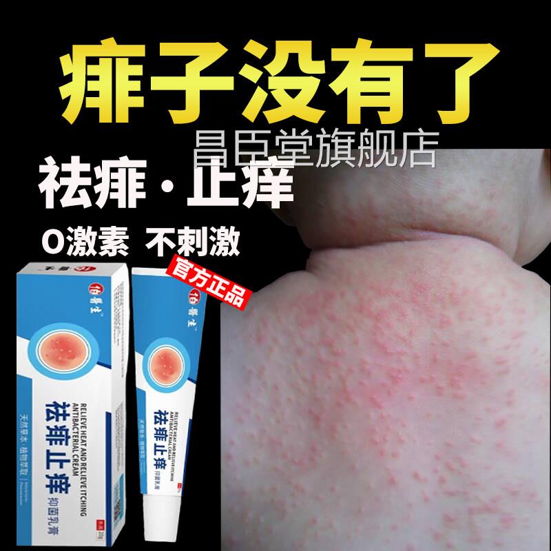 痱子痱膏去止痱痒治宝宝儿童婴儿小孩身上起红痱长热痱药祛神器水