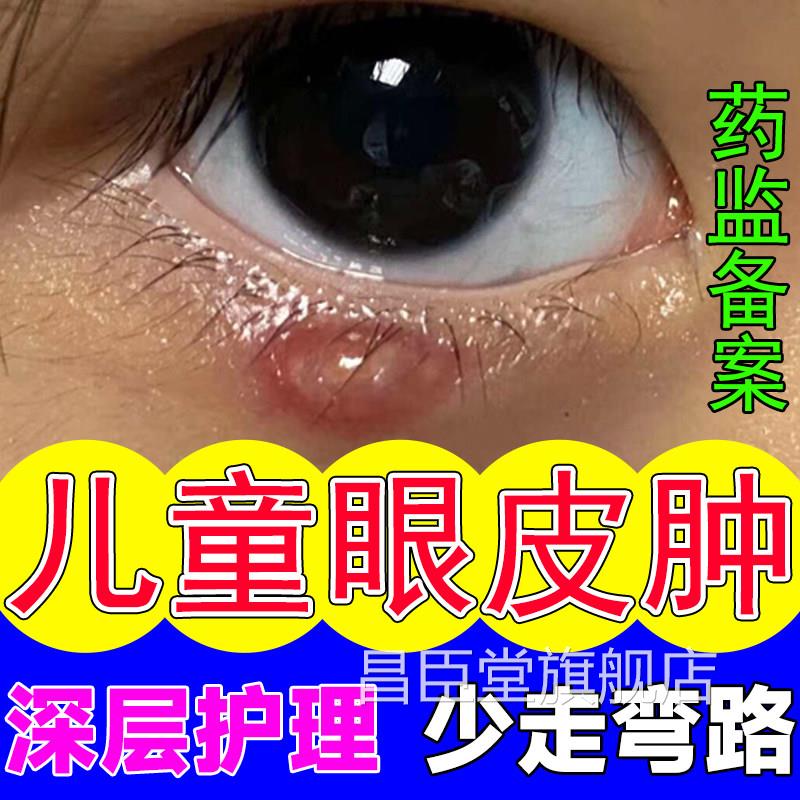 眼睑板堵塞疏通器儿童蒸眼罩霰粒肿眼皮消肿汽麦粒肿热敷眼贴QQ昌
