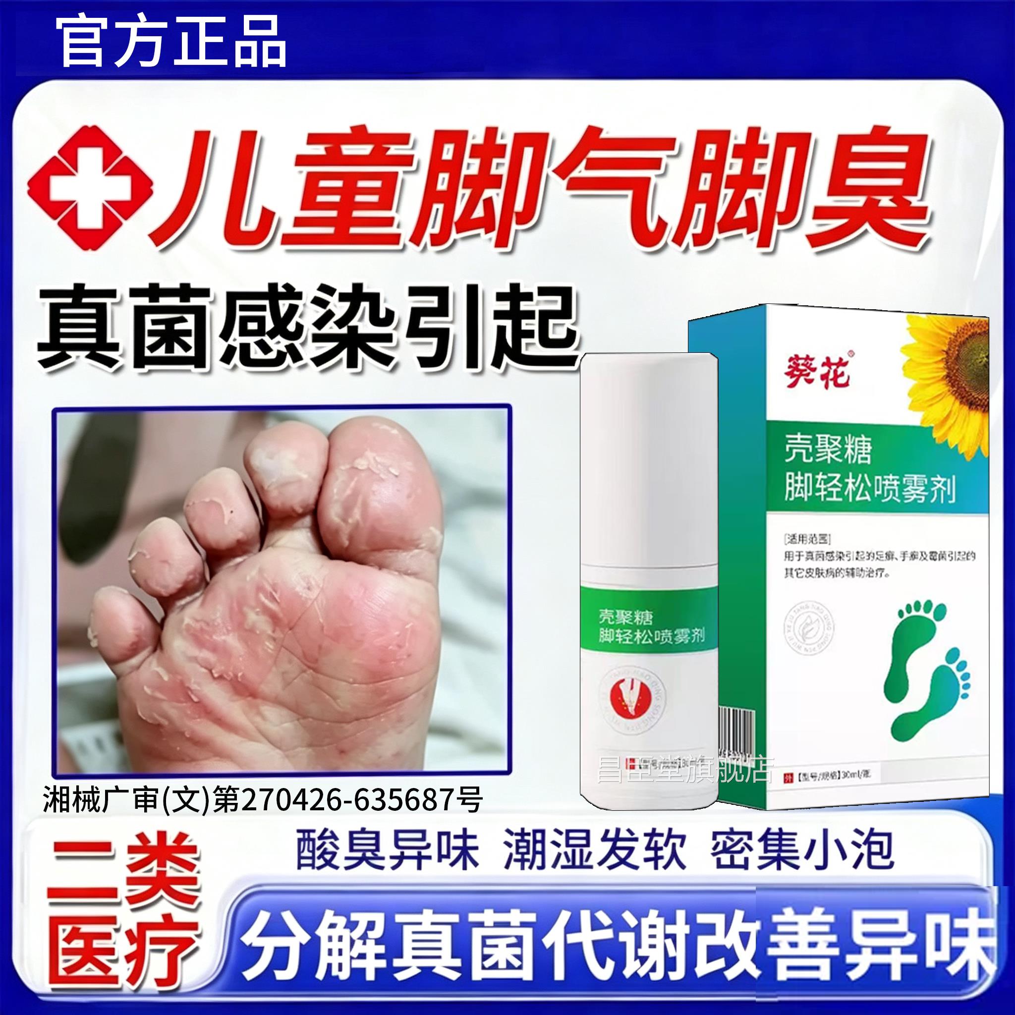 儿童脚气脱皮止痒杀烂脚真菌感染小孩脚痒烂脚丫脚趾喷雾菌XH昌臣