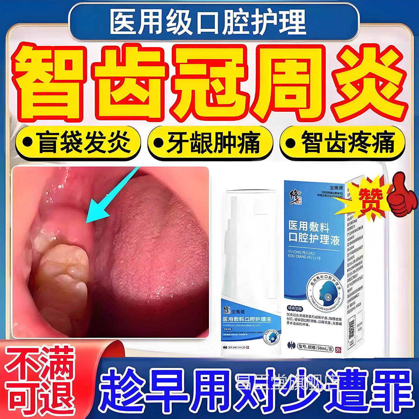 智齿冠周龈炎发炎漱口水牙牙根上火消炎牙齿肿痛喷雾剂药房同售昌