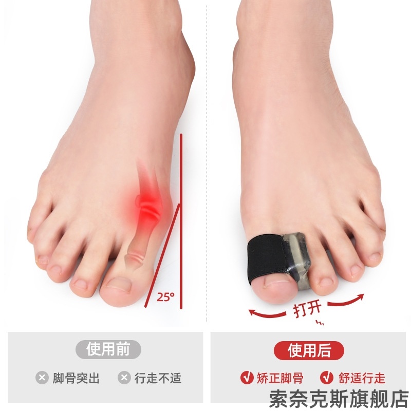 隐形关节男女分离器矫正器可穿骨器形神矫形器脚趾拇指外翻矫正器