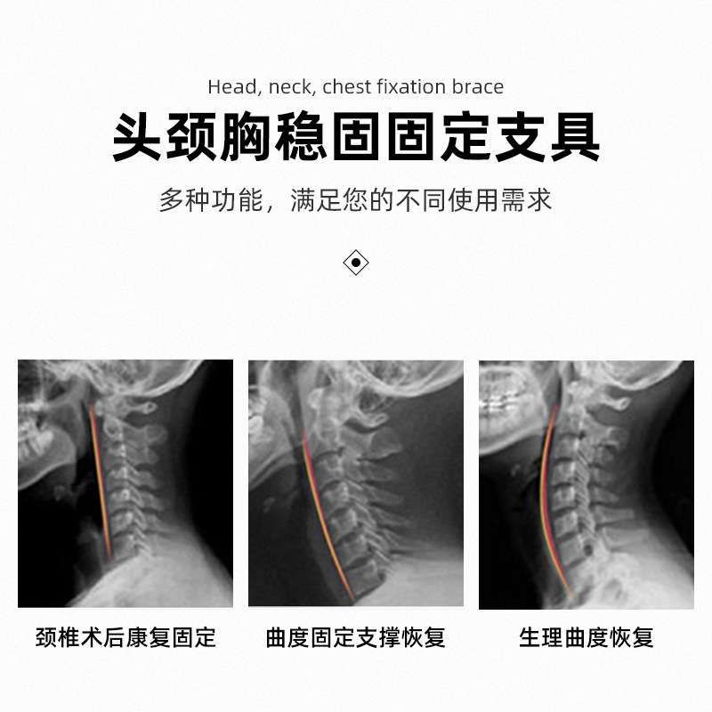 供应头颈胸固定支具成人可调歪脖子矫形器康复颈托