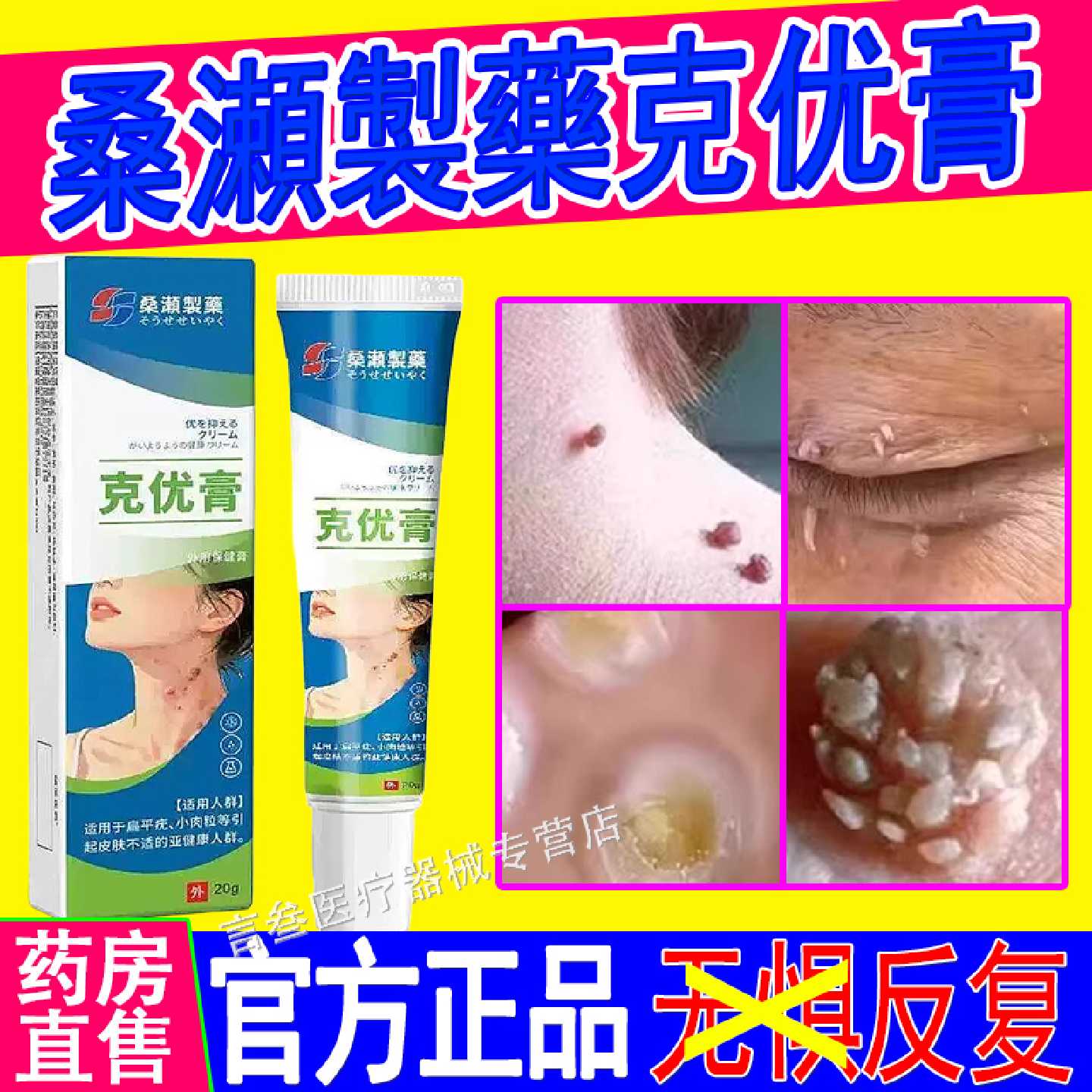 桑瀬製藥克优膏扁平疣一抹灵丝状瘊小肉粒疙瘩猴子去克疣旗舰店