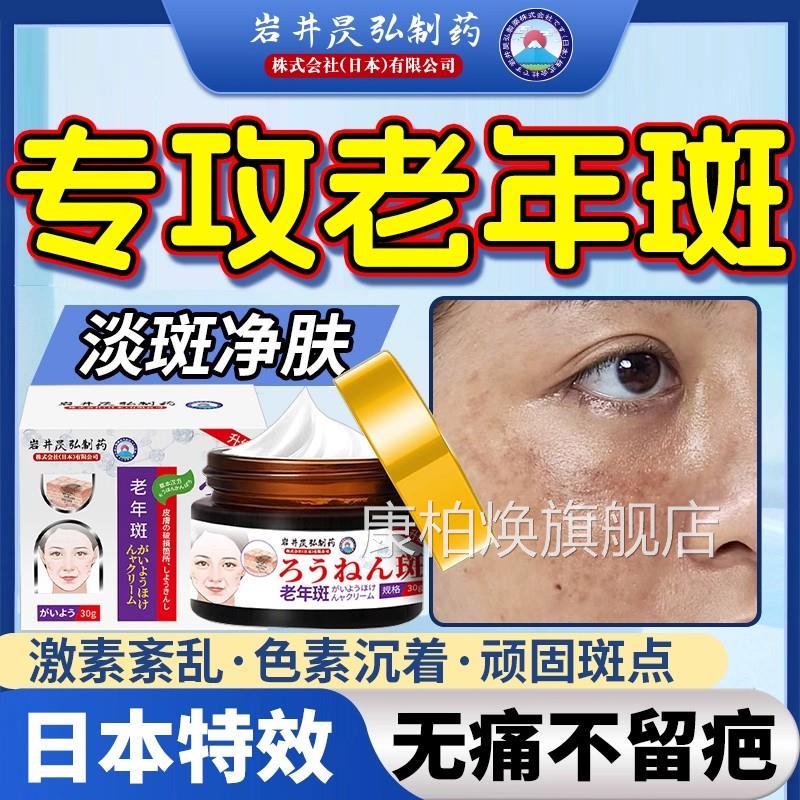 去老人斑专用膏除黑强力去除中药手部老年斑抹净老人一斑擦祛就掉