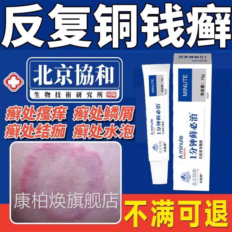 铜钱癣体癣专膏用真菌感染皮肤瘙痒红斑外用药金钱去藓特抑菌效ZZ