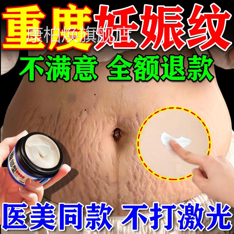 妊纹消除去妊娠纹非紧辰致肚皮非修复霜非淡化除疤痕膏遮盖神器康
