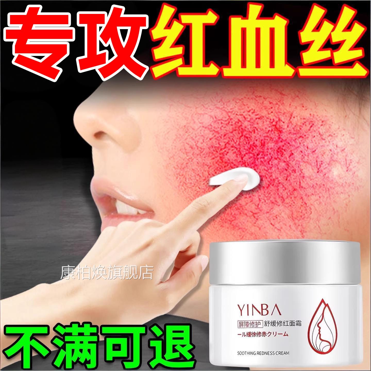 去红血丝增厚质层受损角面霜修红改善面部泛红脸修复皮肤屏障yy康