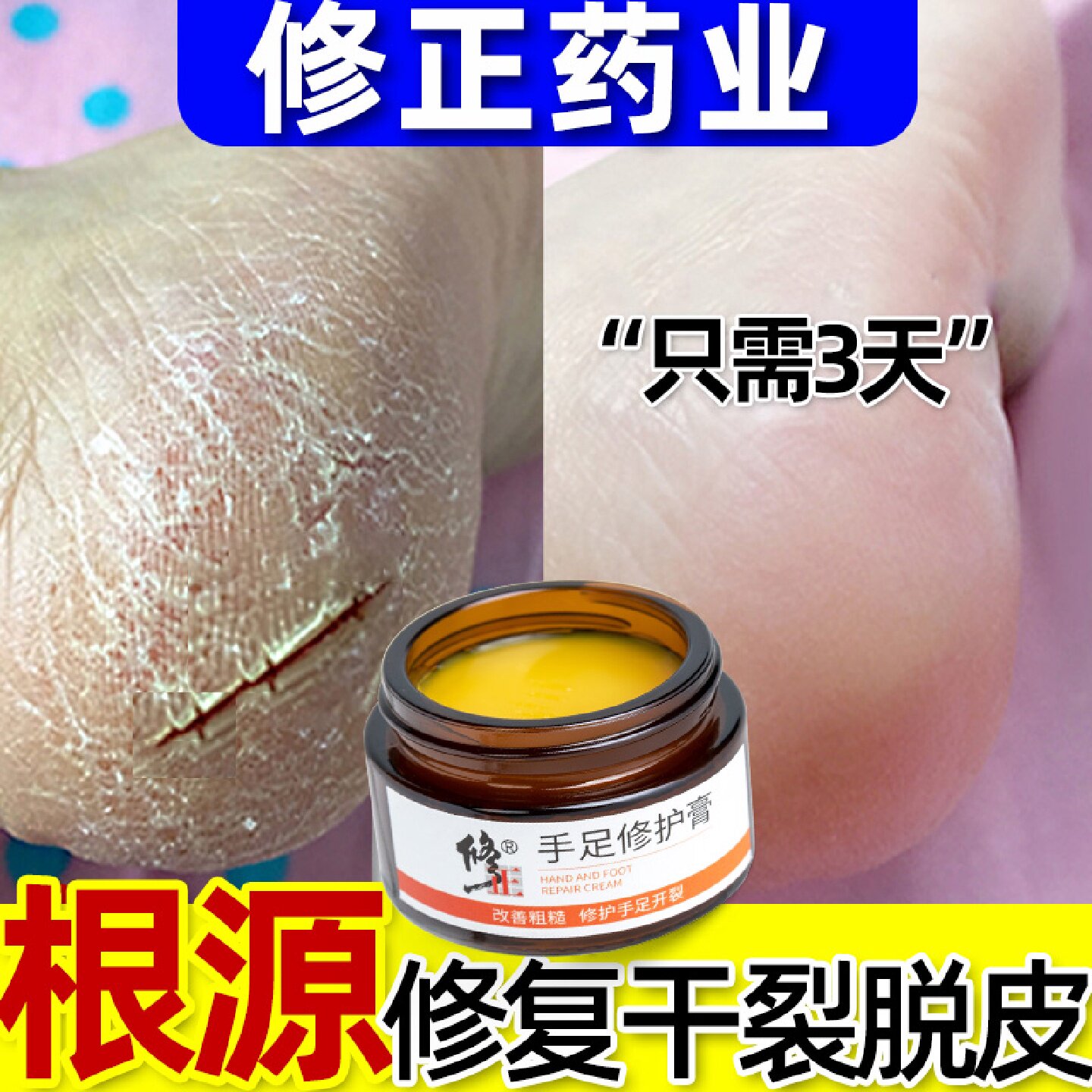 修正脚后跟干裂修复霜手足裂口防裂皲裂开裂愈合龟裂手干燥开旗舰