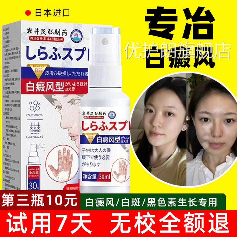 进口白癜药风膏提高免疫力外用快速消白斑黑色素生长神器遮盖液优
