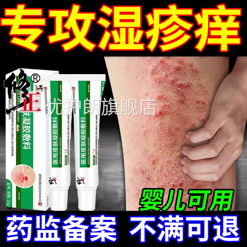 湿毒软膏官方旗舰店糖皮清质激素软膏弱效湿癣疹祛根湿痒乳优护朗
