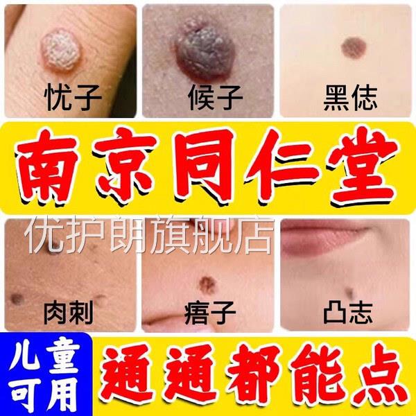 祛点志膏无痕去非药水去黑脸部美容不留疤官方正品旗舰店nn优护朗