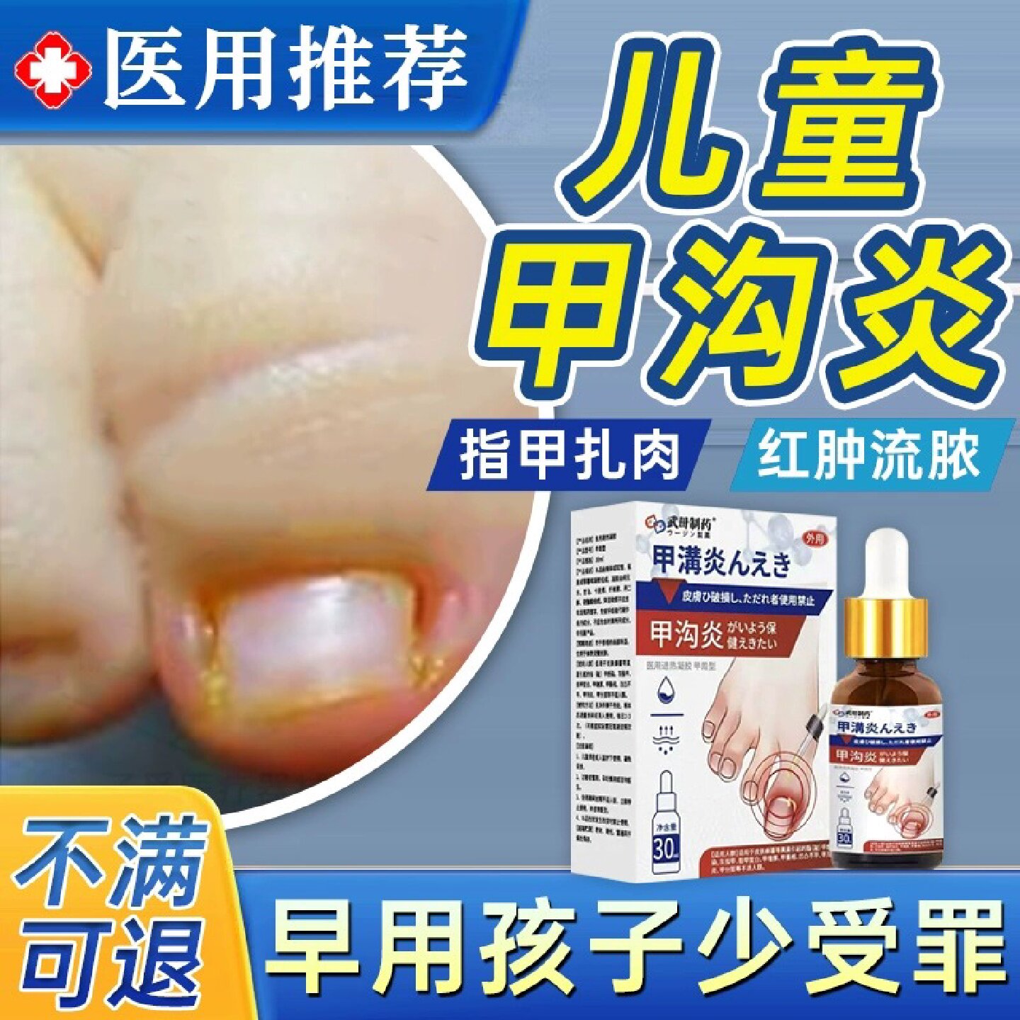 儿童甲沟炎治疗特效灰指甲膏息肉去除矫正器消炎脚大拇指软化嵌旗