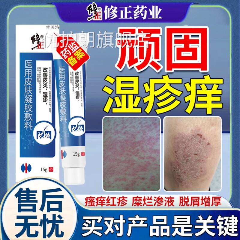 湿毒去清软膏湿祛湿z痒根官方旗舰店湿毒止痒皮肤液专用除湿膏YS