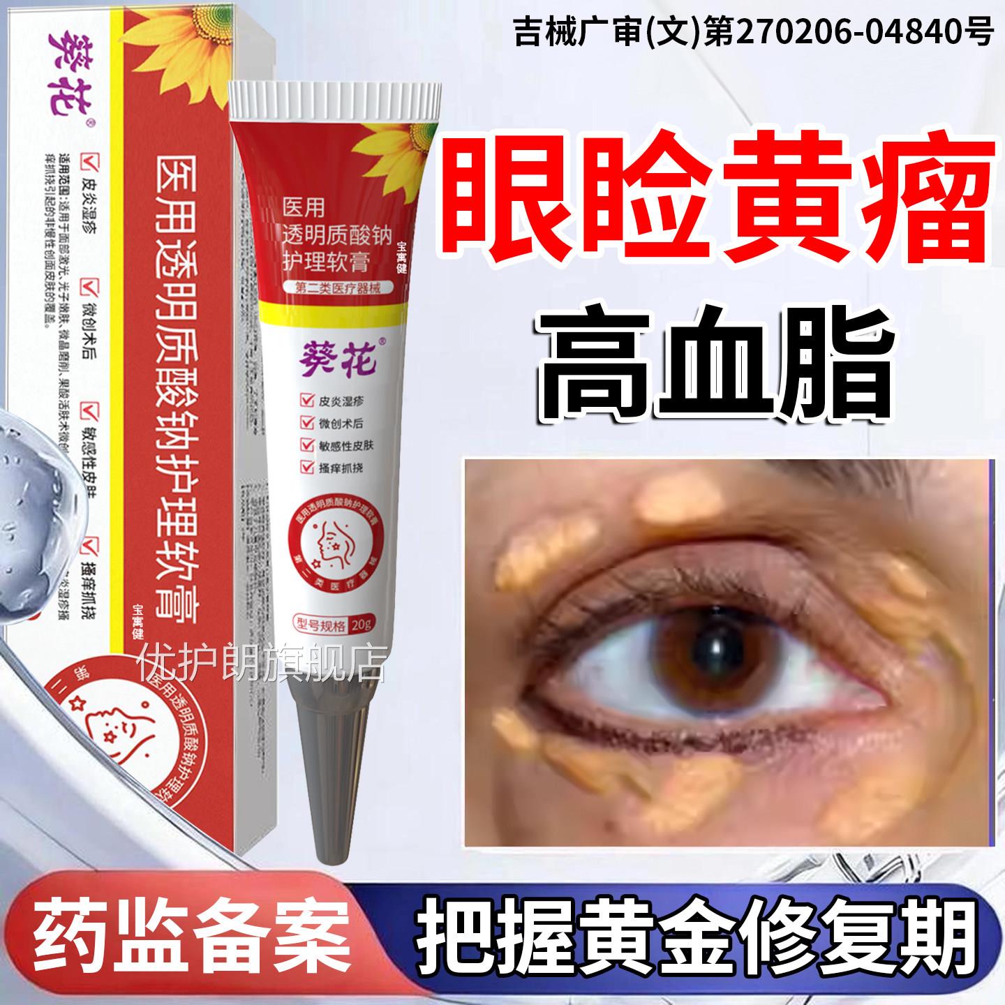 睑黄瘤瘤去除神器眼睑黄瘤疣去眼皮黄斑疣专用膏血脂高眼部脂肪粒