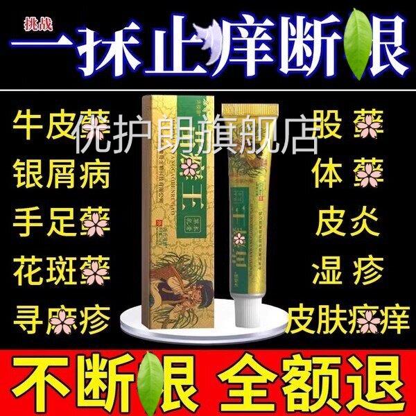 苗藓王药膏头皮股银藓藓屑病皮肤杀菌藓专用止痒官方牛正品官方优