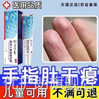 手指肚干脱皮干裂手指腹瘪部竖纹凹陷褶皱角化性湿疹真菌感染膏WY