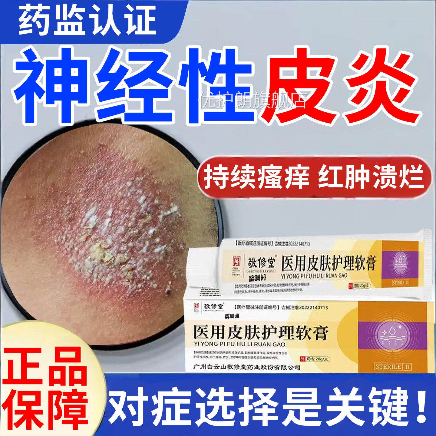 神经性皮炎去祛除外用膏顽固无激素皮肤痒止真菌疗感染非治根药优