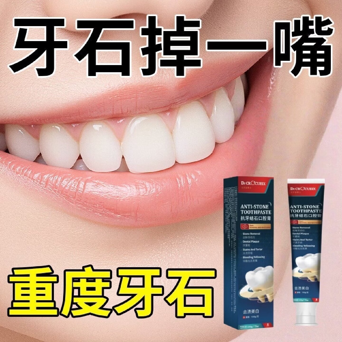 克罗意博士抗牙结石口腔膏清新口气去黄牙结石牙渍牙龈旗舰店