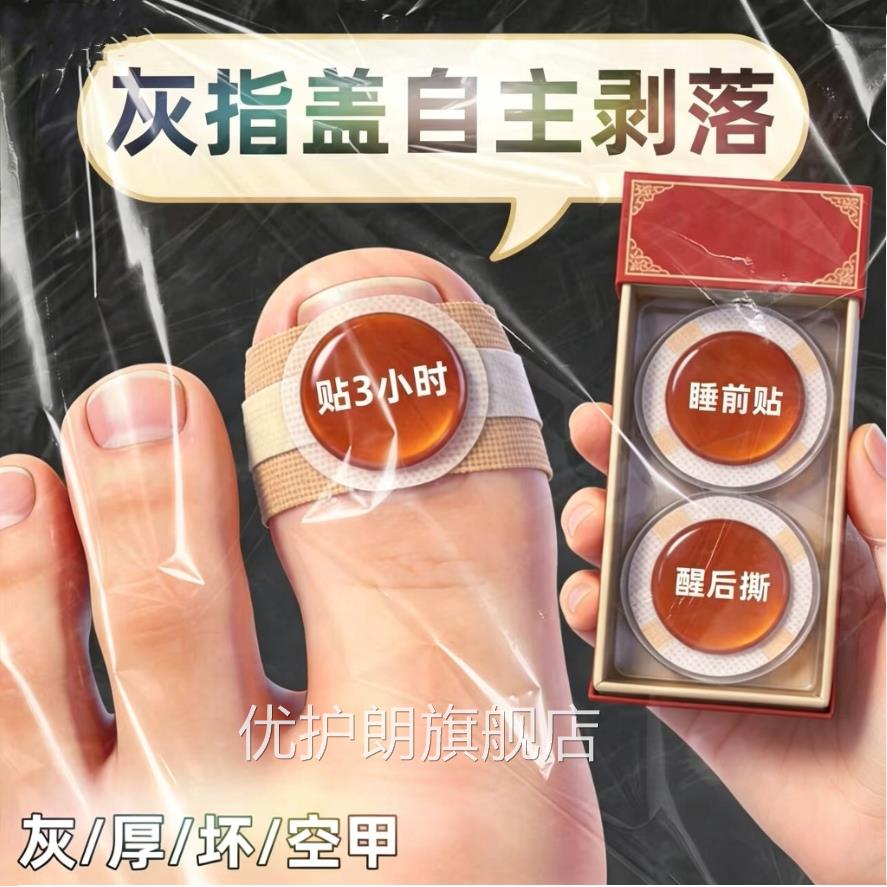 【官正品】指甲贴正品专用灰趾贴植物萃取脚趾方手指甲修护专用贴