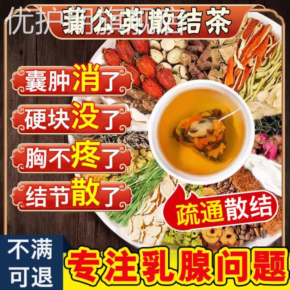 蒲公英乳腺增生结节散结茶贴疏通散结硬块囊肿乳房胀痛药舒碧特UU