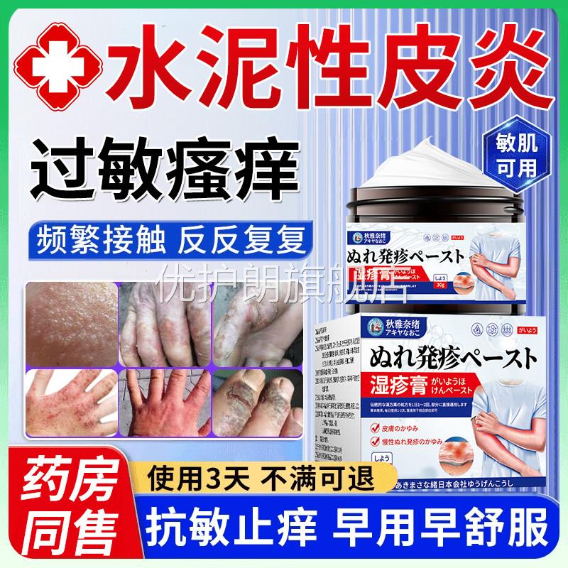 治水泥过敏建筑专用手痒起水泡皮肤瘙痒湿疹脱皮止痒长藓的外用膏