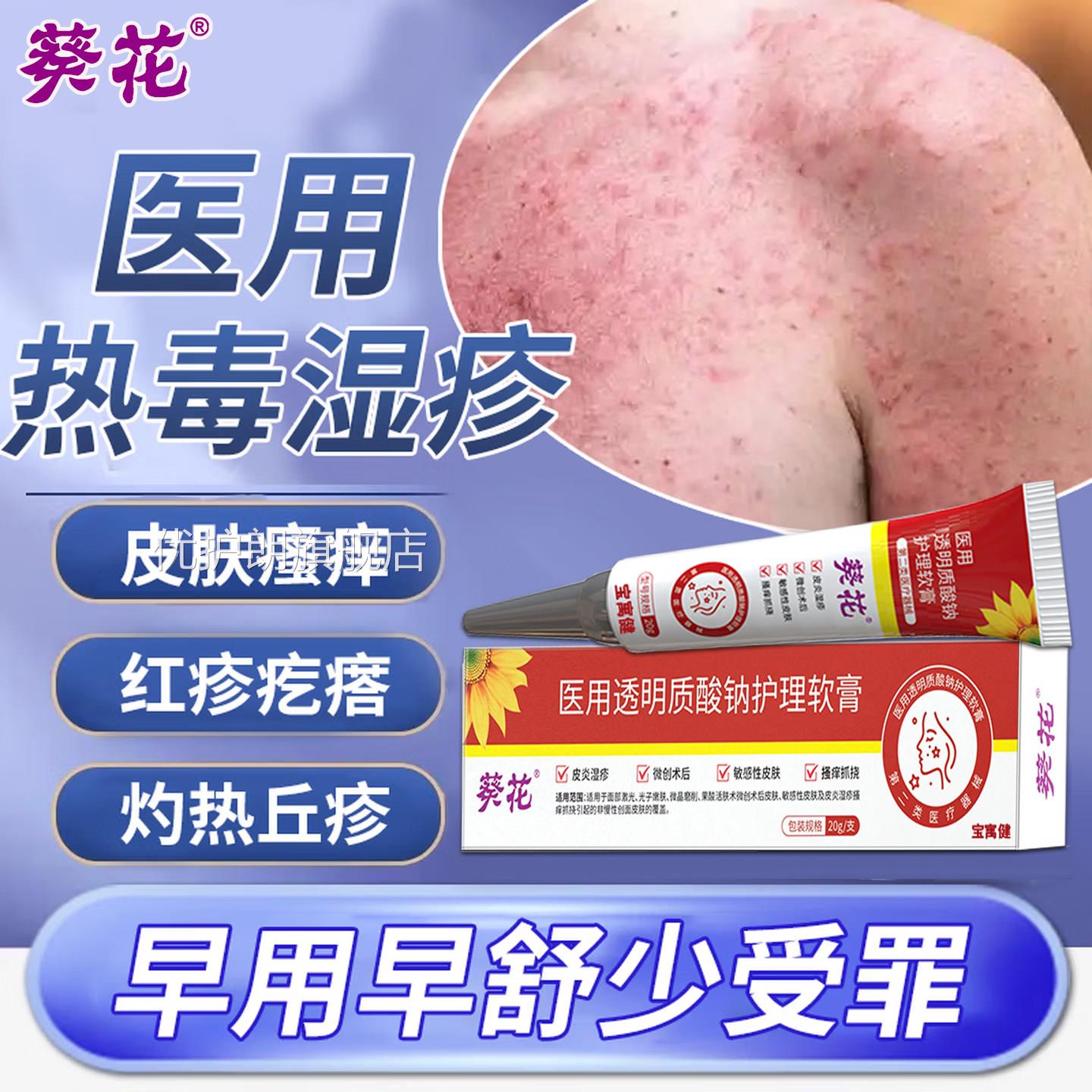 热毒湿疹止痒膏苗医湿皮肤一热就痒苗方除湿皮炎瘙痒红血热型毒清