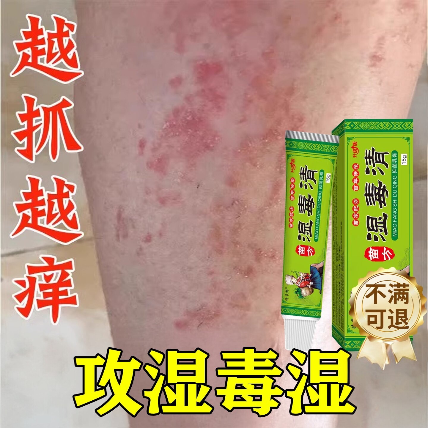 湿毒清软膏湿热止湿痒祛痒根皮肤皮瘙炎痒水泡治除湿旗舰店