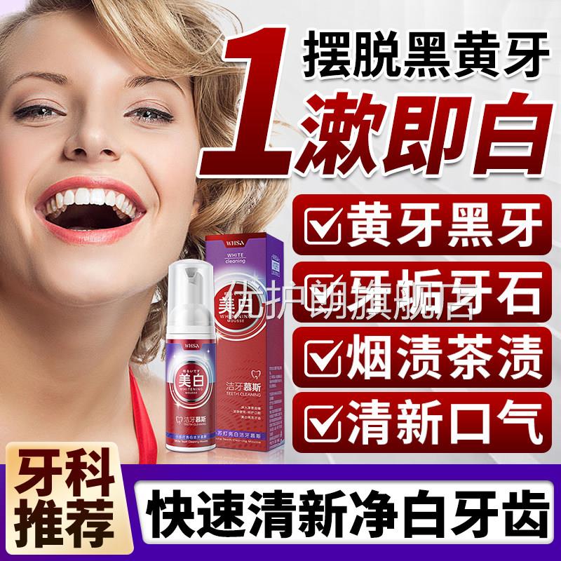 洁牙慕斯去黄去口臭牙结石美白清新口气小苏打牙旗膏官方舰店正品