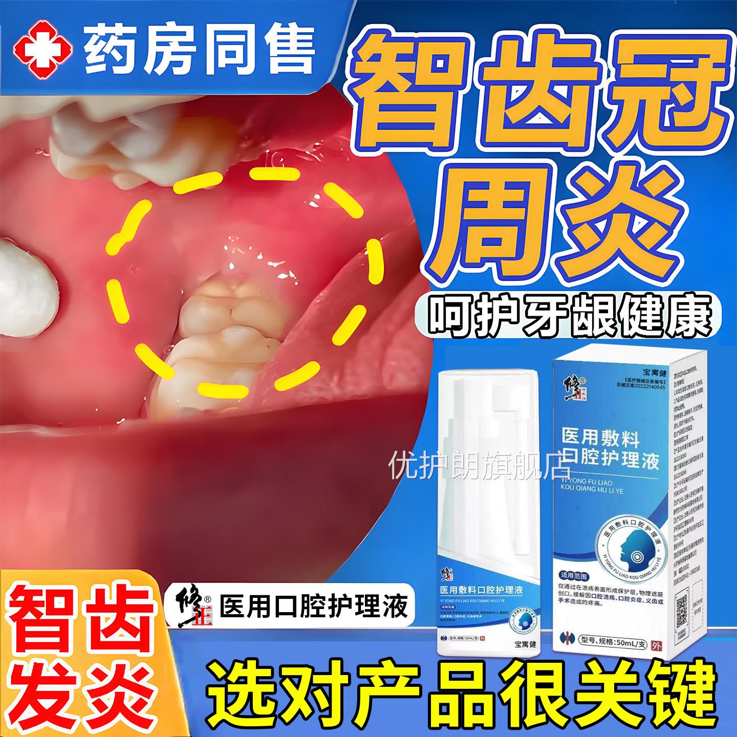 水智齿冠周炎牙龈肿痛脓包药房同售牙膏漱口用牙疼牙痛喷雾喷剂优