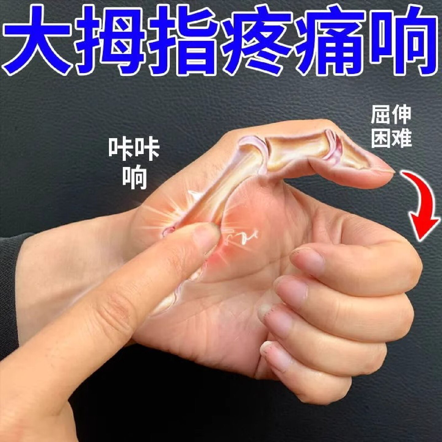 腱鞘焱手腕大拇指手指膏囊肿专用疼痛膏肘关节鼓包膏药旗舰店