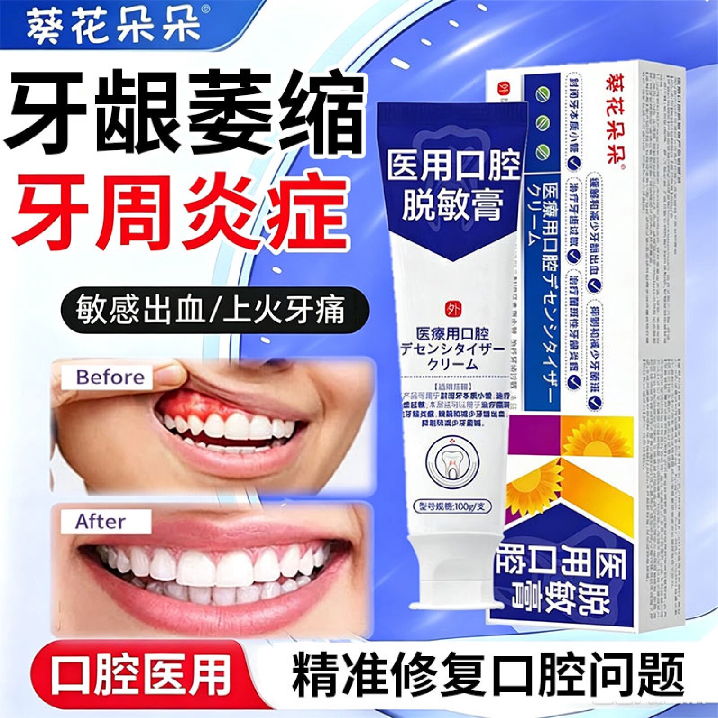 牙膏治牙周炎口腔牙龈萎缩牙齿松动医用脱敏专用牙膏修复旗舰店